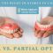 Choosing the Right Dentures in Charleston: Full vs. Partial Options (featured image)