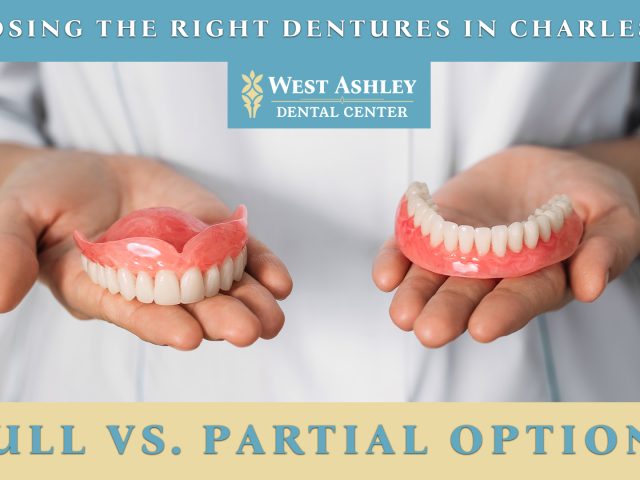 Choosing the Right Dentures in Charleston: Full vs. Partial Options (featured image)