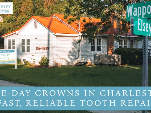 Same-Day Crowns in Charleston: Fast, Reliable Tooth Repair (featured image)